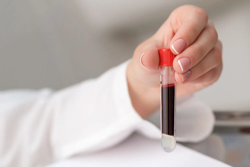 Lekarka trzymająca fiolkę z krwią, ilustrując autohemoterapię.